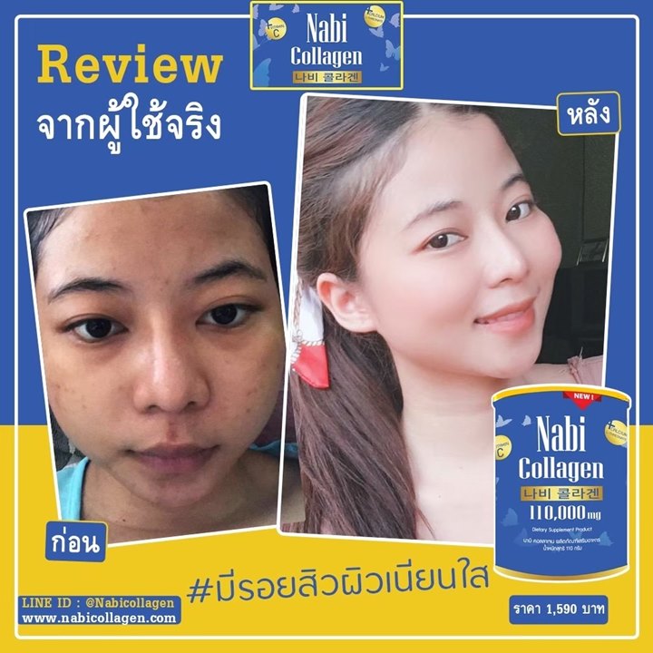 รีวิว-วิธีกิน-Nabi-Collagen-เกาหลี